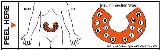 Insulin Injection Rotation Sites Chart